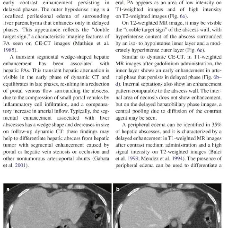 Sách Imaging of the Liver and Intra-hepatic Biliary Tract Volume 2