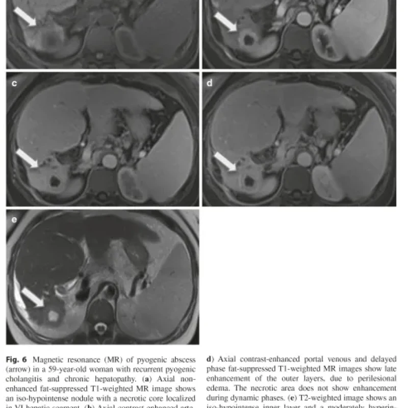 Sách Imaging of the Liver and Intra-hepatic Biliary Tract Volume 2