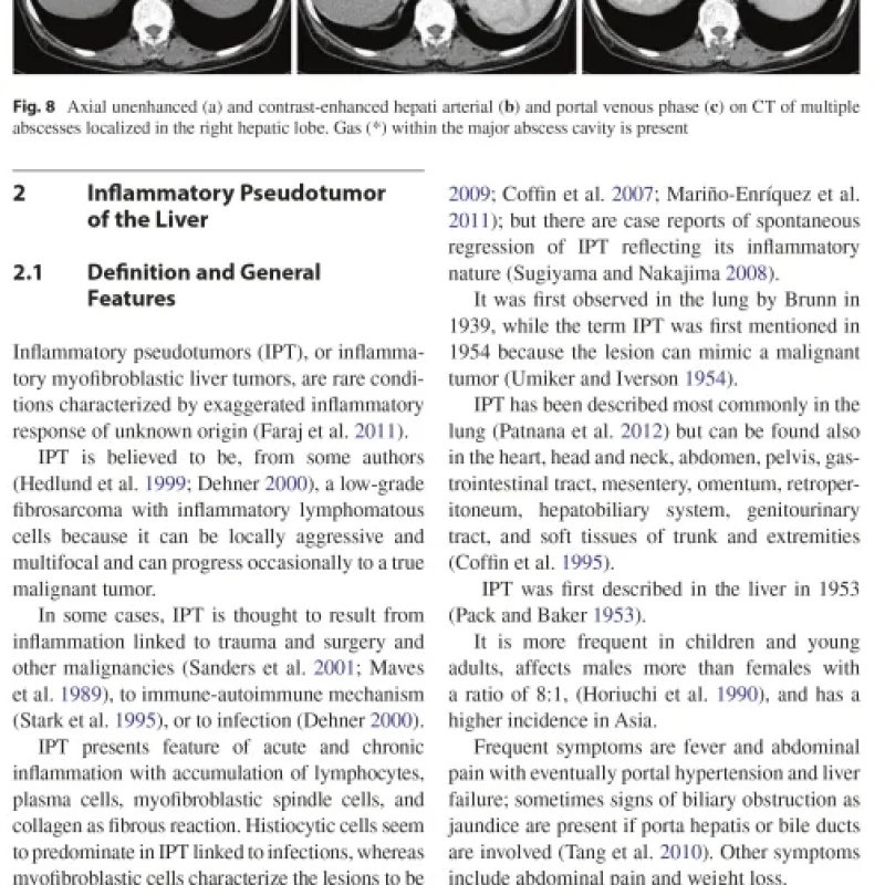 Sách Imaging of the Liver and Intra-hepatic Biliary Tract Volume 2
